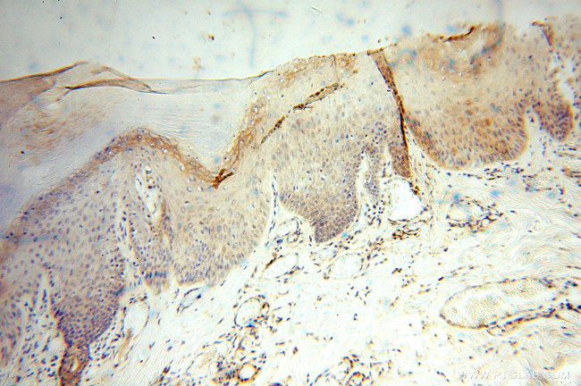 ANXA9 Antibody in Immunohistochemistry (Paraffin) (IHC (P))