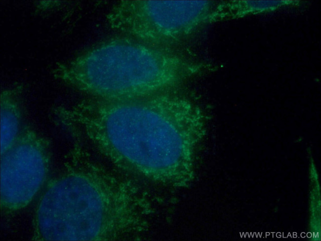 BDH1 Antibody in Immunocytochemistry (ICC/IF)