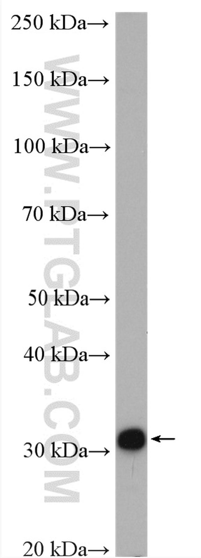 BDH1 Antibody in Western Blot (WB)