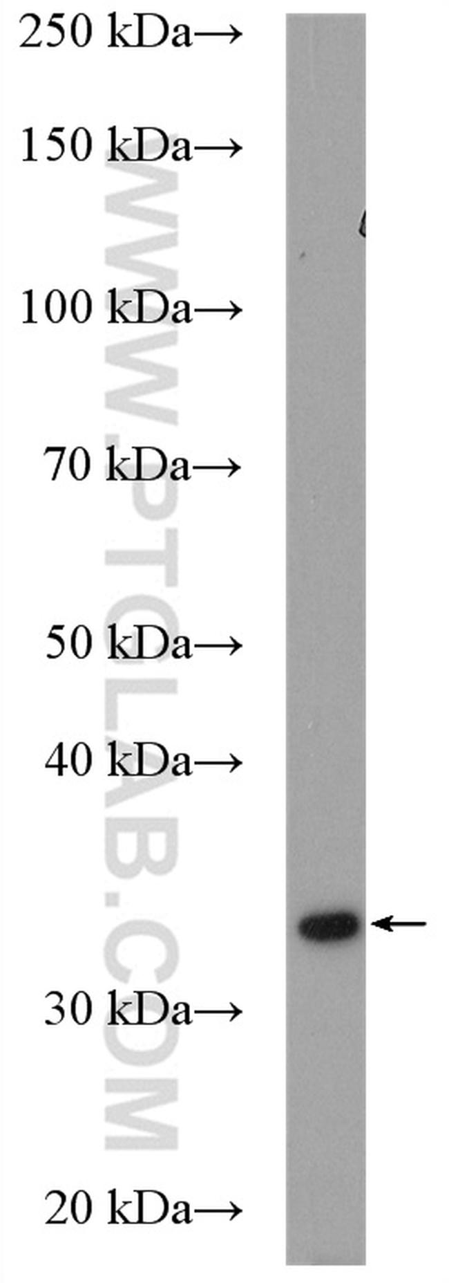 BDH1 Antibody in Western Blot (WB)