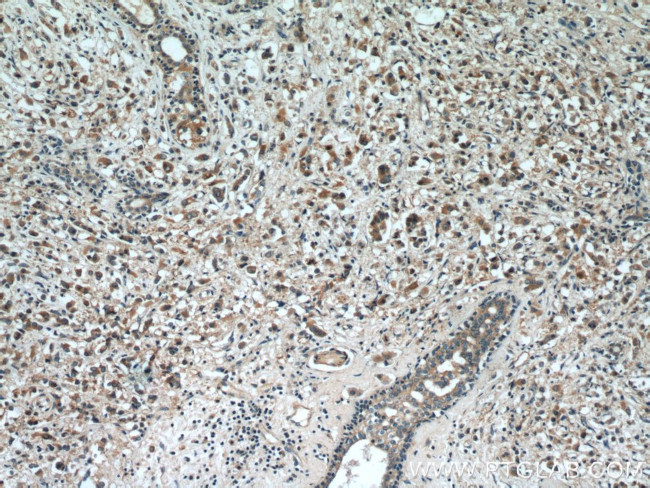 RAB2 Antibody in Immunohistochemistry (Paraffin) (IHC (P))