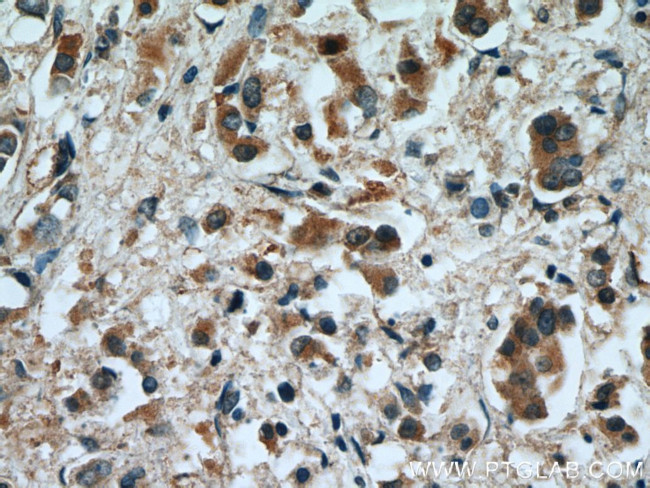 RAB2 Antibody in Immunohistochemistry (Paraffin) (IHC (P))