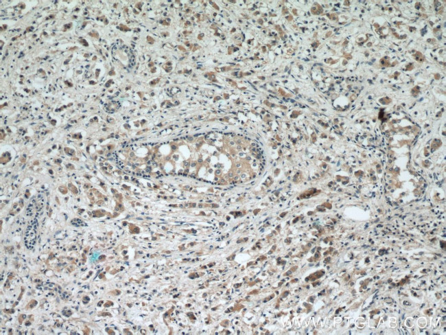 RAB2 Antibody in Immunohistochemistry (Paraffin) (IHC (P))