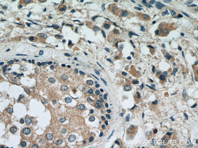 RAB2 Antibody in Immunohistochemistry (Paraffin) (IHC (P))