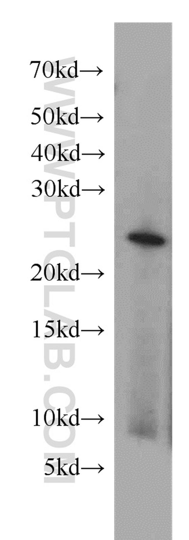 RAB2 Antibody in Western Blot (WB)