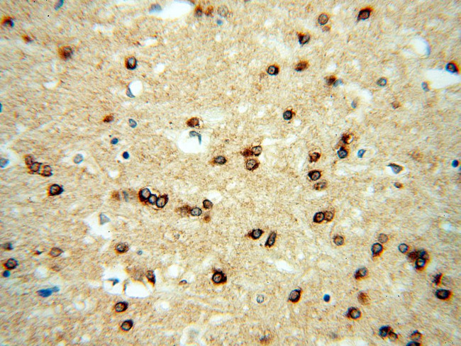 RAB2 Antibody in Immunohistochemistry (Paraffin) (IHC (P))