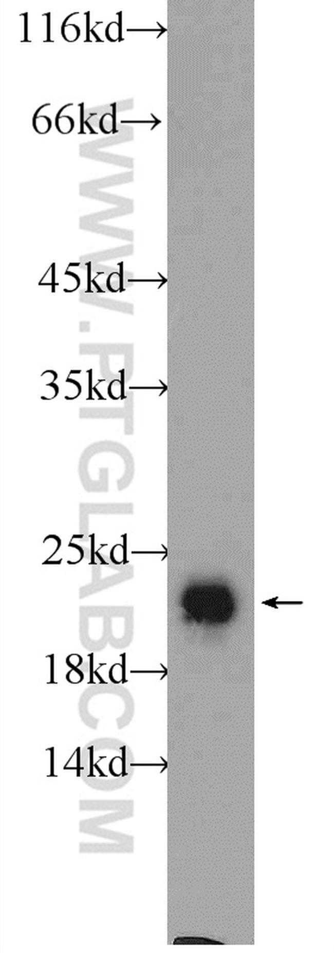 RAB2 Antibody in Western Blot (WB)