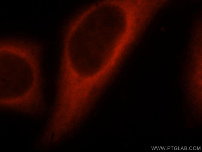 ATP citrate lyase Antibody in Immunocytochemistry (ICC/IF)