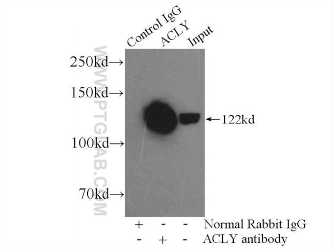 ATP citrate lyase Antibody in Immunoprecipitation (IP)