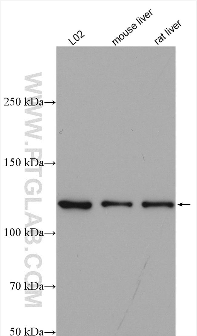 ATP citrate lyase Antibody in Western Blot (WB)