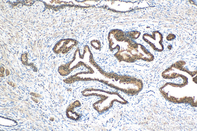 ATP citrate lyase Antibody in Immunohistochemistry (Paraffin) (IHC (P))