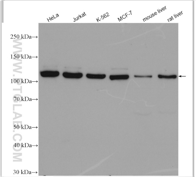 ATP citrate lyase Antibody in Western Blot (WB)