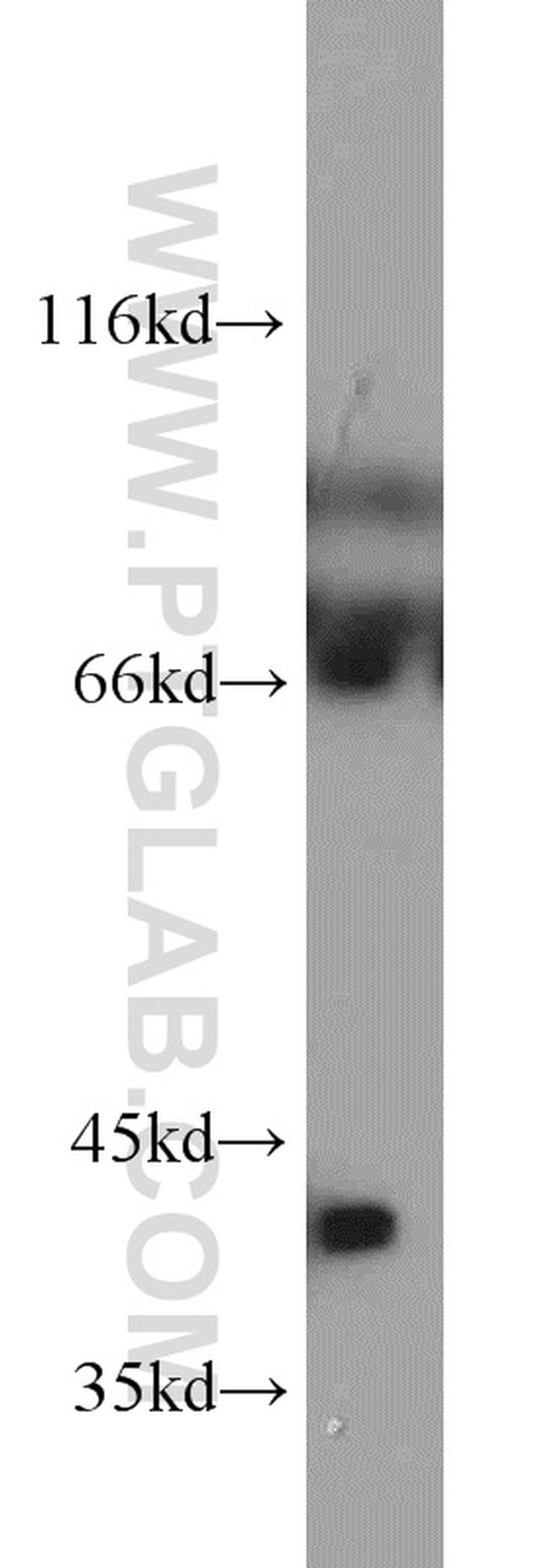 Bif-1 Antibody in Western Blot (WB)