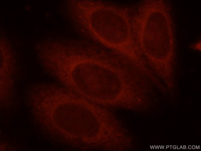 Bif-1 Antibody in Immunocytochemistry (ICC/IF)