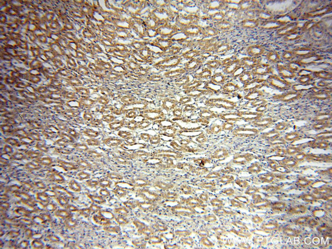 Bif-1 Antibody in Immunohistochemistry (Paraffin) (IHC (P))