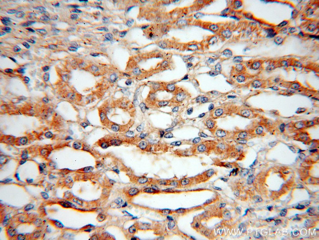 Bif-1 Antibody in Immunohistochemistry (Paraffin) (IHC (P))