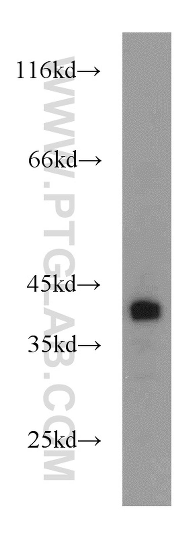 Bif-1 Antibody in Western Blot (WB)