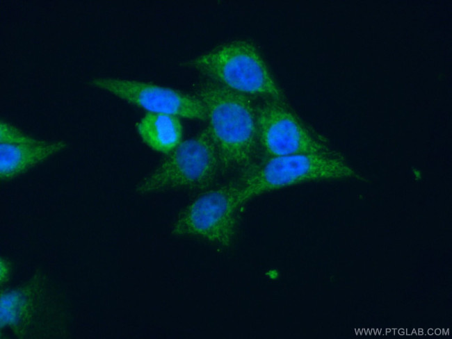 MAPKAPK3 Antibody in Immunocytochemistry (ICC/IF)