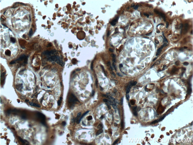 MAPKAPK3 Antibody in Immunohistochemistry (Paraffin) (IHC (P))