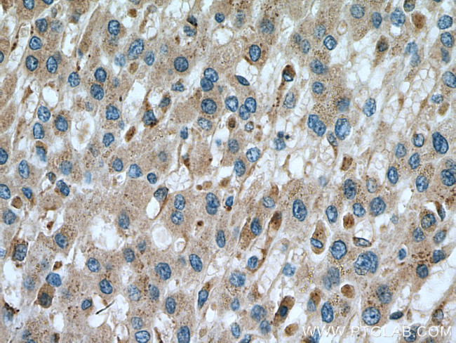 Alpha galactosidase A Antibody in Immunohistochemistry (Paraffin) (IHC (P))