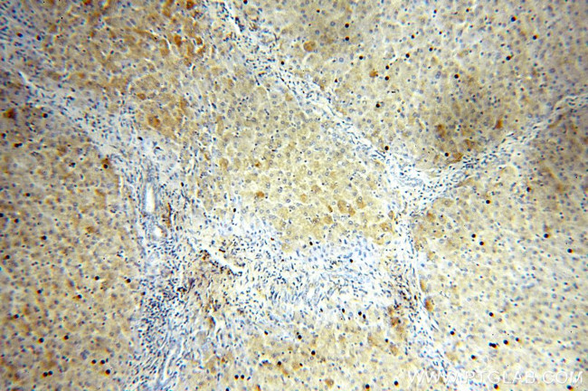 Alpha galactosidase A Antibody in Immunohistochemistry (Paraffin) (IHC (P))