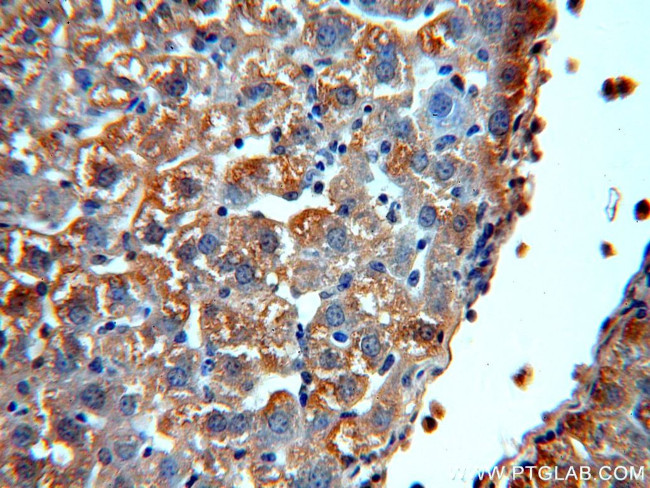 Alpha galactosidase A Antibody in Immunohistochemistry (Paraffin) (IHC (P))