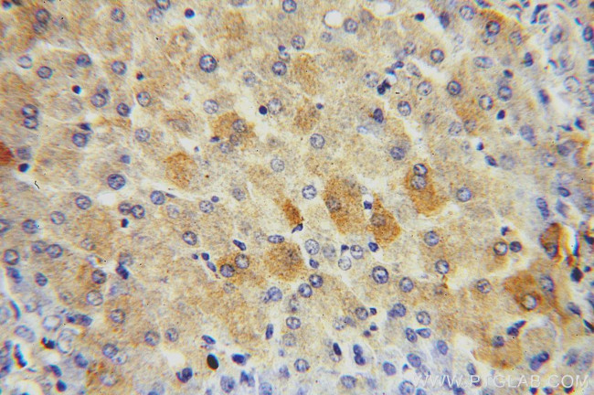 Alpha galactosidase A Antibody in Immunohistochemistry (Paraffin) (IHC (P))