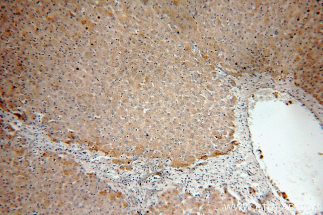 Alpha galactosidase A Antibody in Immunohistochemistry (Paraffin) (IHC (P))