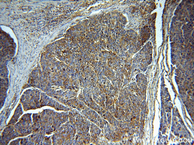 Alpha galactosidase A Antibody in Immunohistochemistry (Paraffin) (IHC (P))