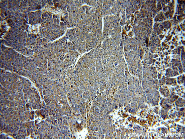 Alpha galactosidase A Antibody in Immunohistochemistry (Paraffin) (IHC (P))