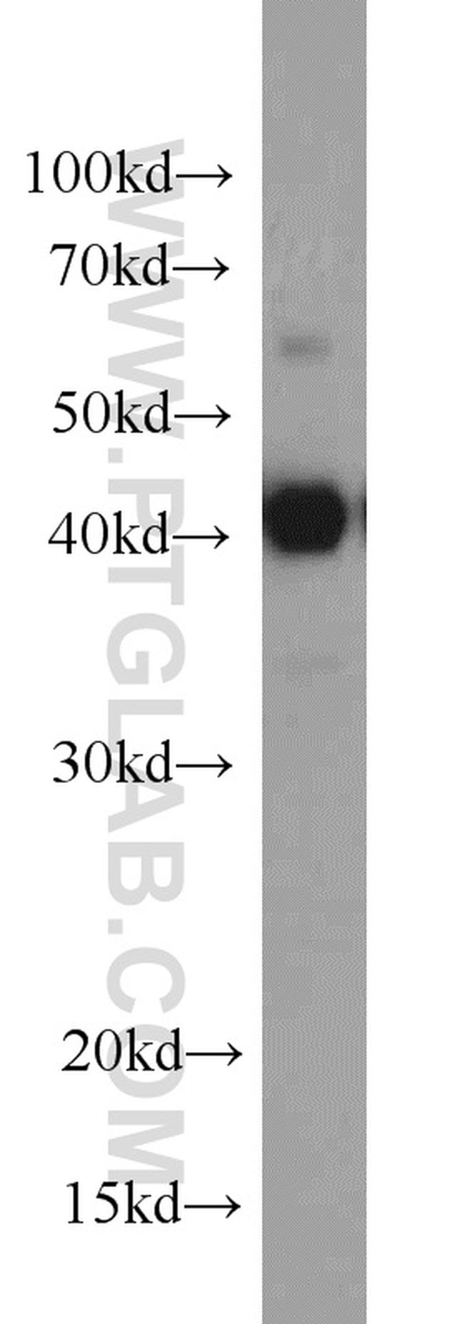 Alpha galactosidase A Antibody in Western Blot (WB)