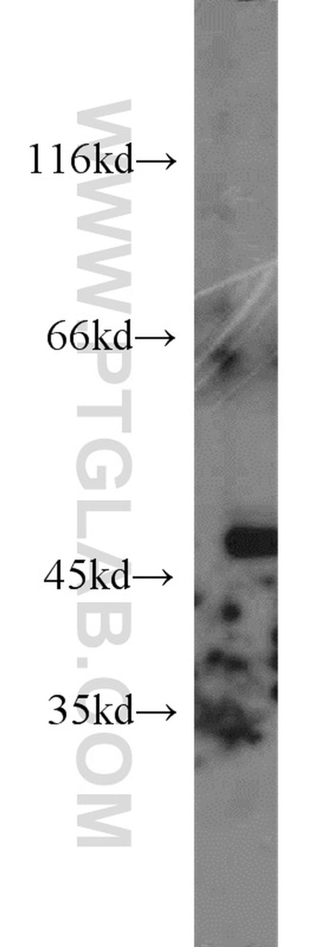 Alpha galactosidase A Antibody in Western Blot (WB)