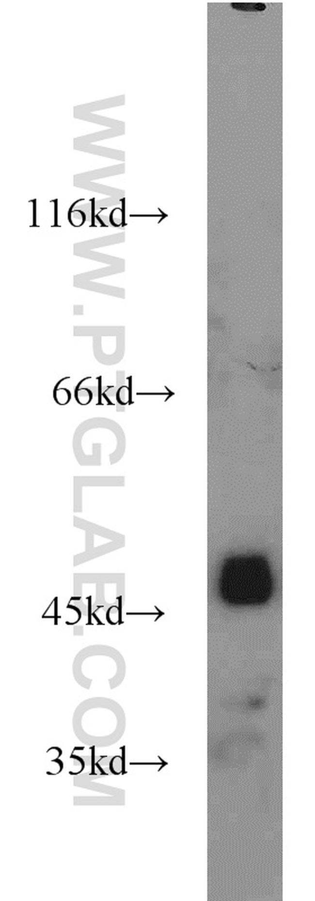 Alpha galactosidase A Antibody in Western Blot (WB)