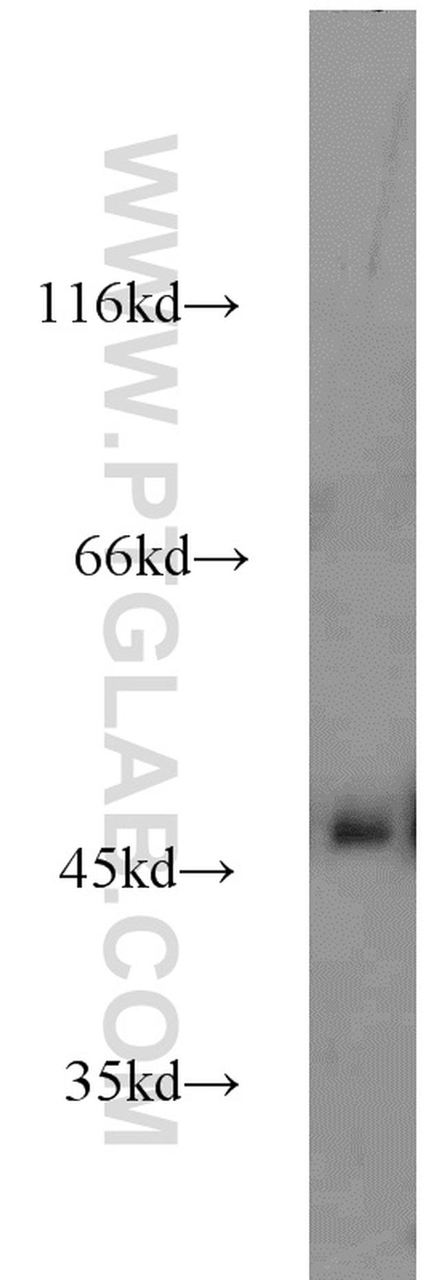 Alpha galactosidase A Antibody in Western Blot (WB)