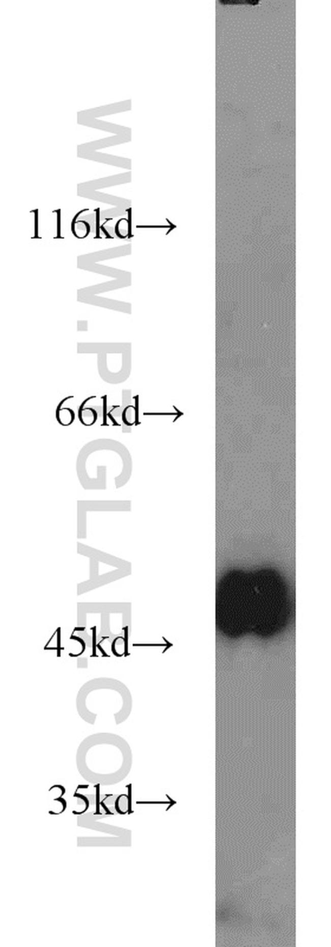 Alpha galactosidase A Antibody in Western Blot (WB)