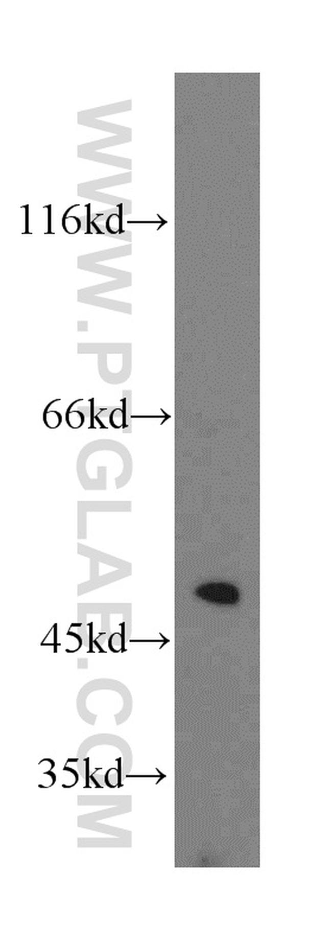 Alpha galactosidase A Antibody in Western Blot (WB)