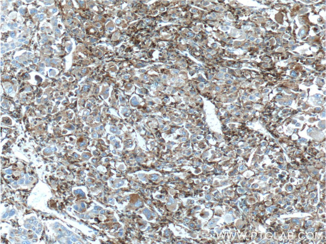 Alpha galactosidase A Antibody in Immunohistochemistry (Paraffin) (IHC (P))