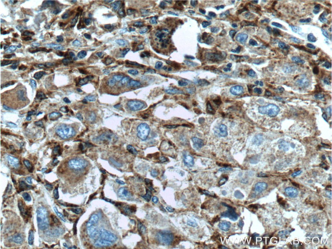 Alpha galactosidase A Antibody in Immunohistochemistry (Paraffin) (IHC (P))