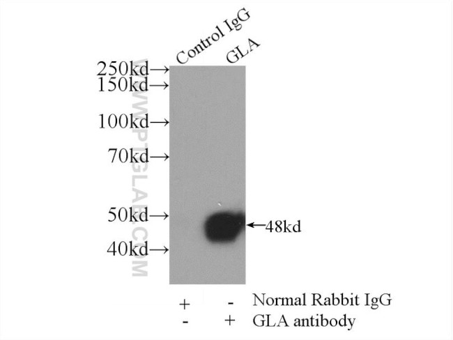 Alpha galactosidase A Antibody in Immunoprecipitation (IP)