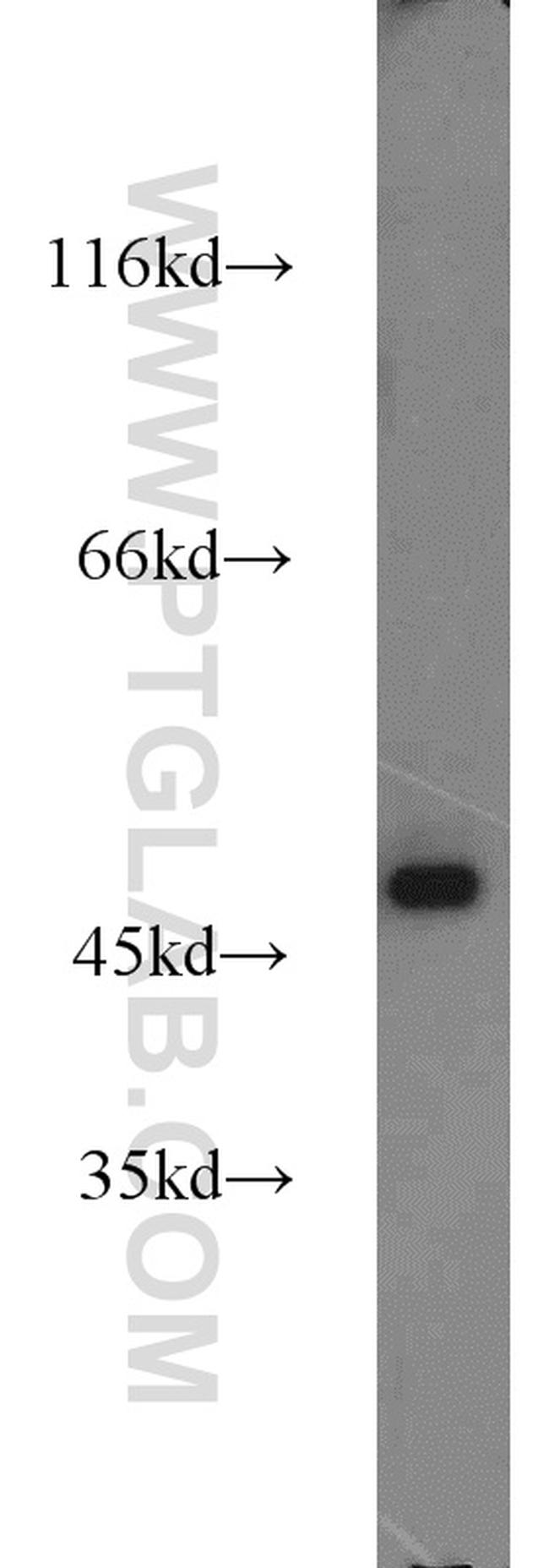 Alpha galactosidase A Antibody in Western Blot (WB)