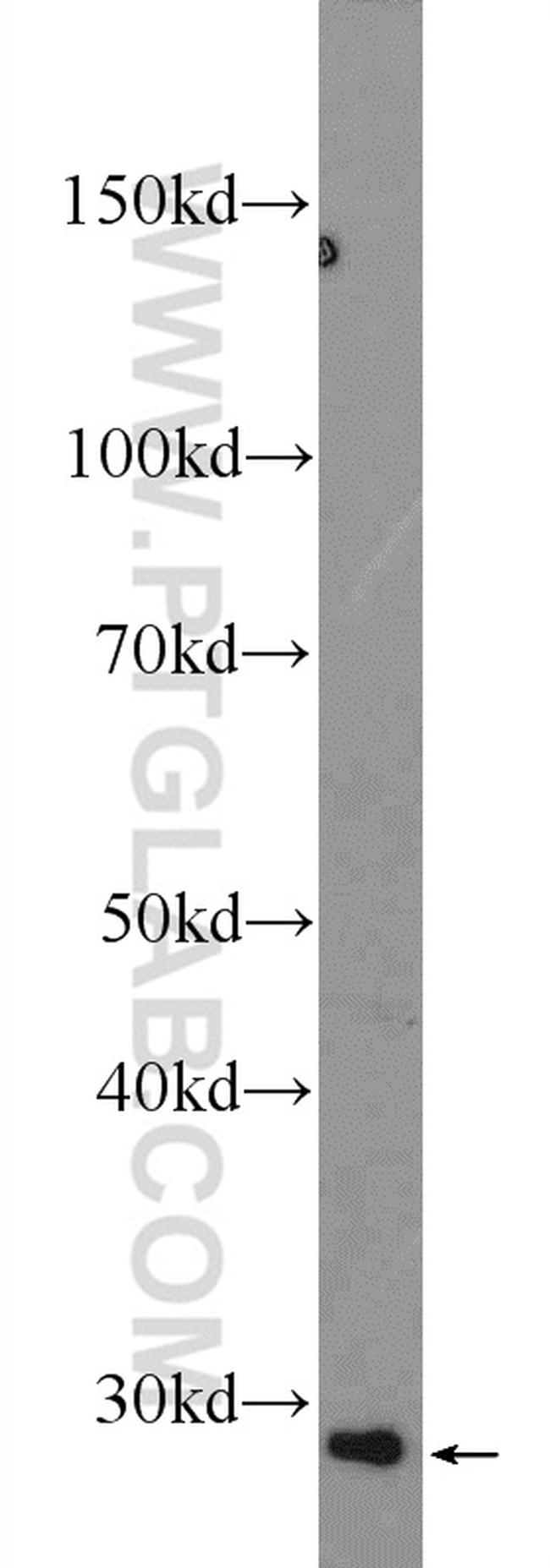 PPT2 Antibody in Western Blot (WB)