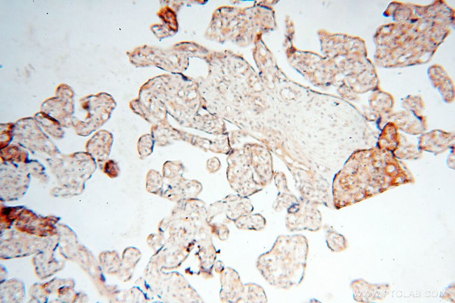 CA11 Antibody in Immunohistochemistry (Paraffin) (IHC (P))