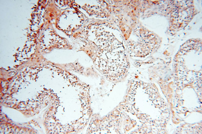 CA11 Antibody in Immunohistochemistry (Paraffin) (IHC (P))