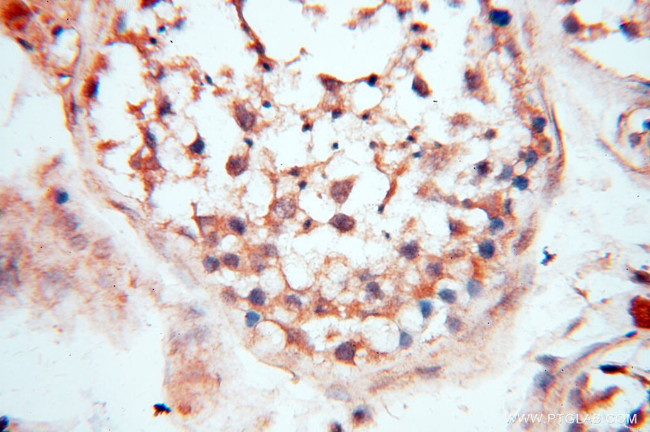 CA11 Antibody in Immunohistochemistry (Paraffin) (IHC (P))