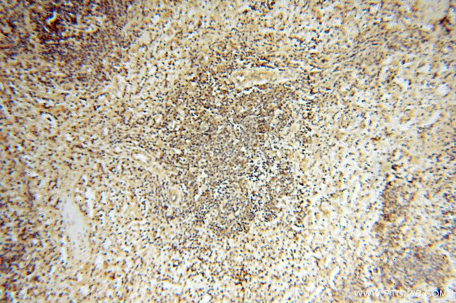 CA11 Antibody in Immunohistochemistry (Paraffin) (IHC (P))