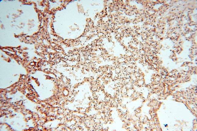 CA11 Antibody in Immunohistochemistry (Paraffin) (IHC (P))