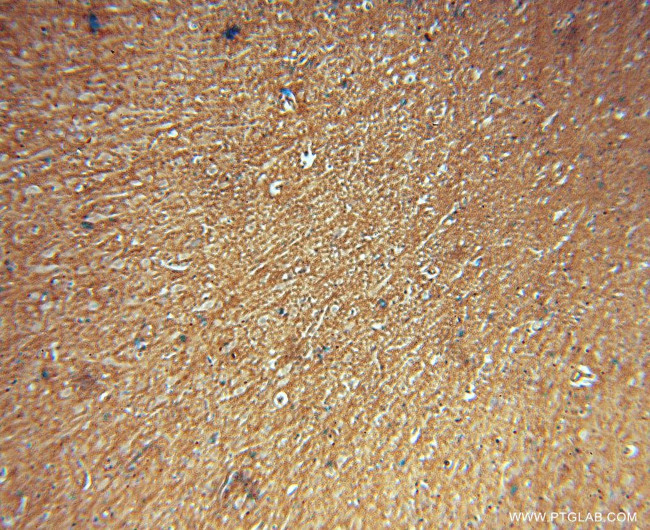 CA11 Antibody in Immunohistochemistry (Paraffin) (IHC (P))