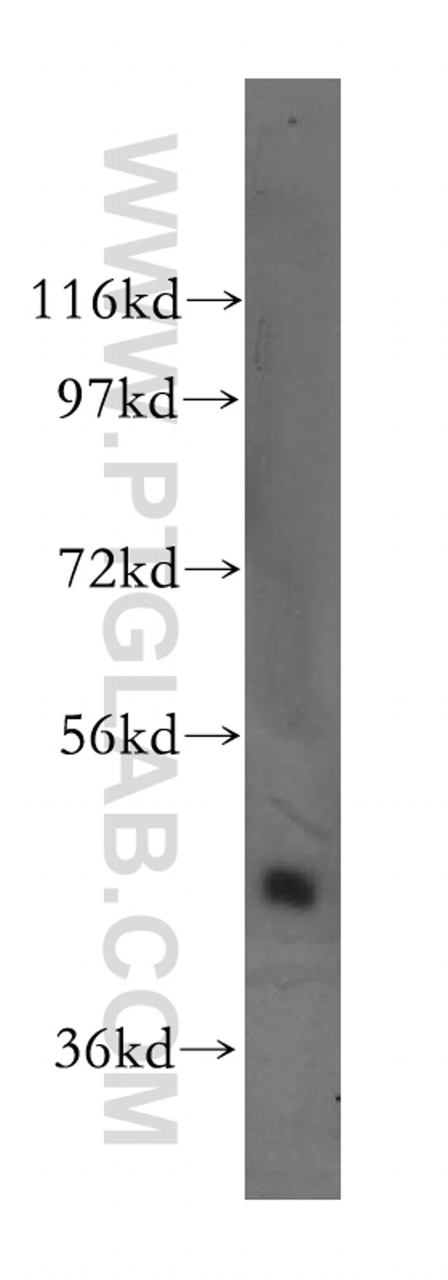 STK32B Antibody in Western Blot (WB)