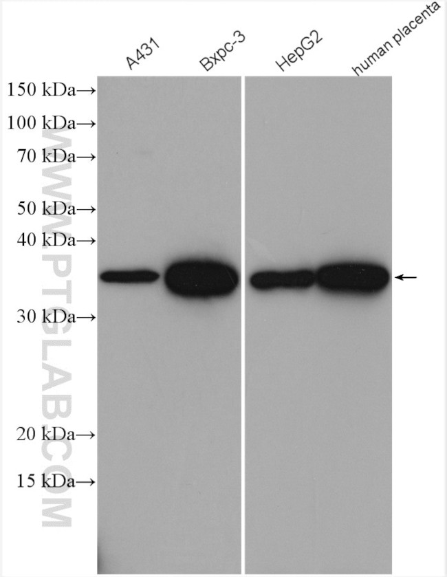 AKR1B1 Antibody in Western Blot (WB)