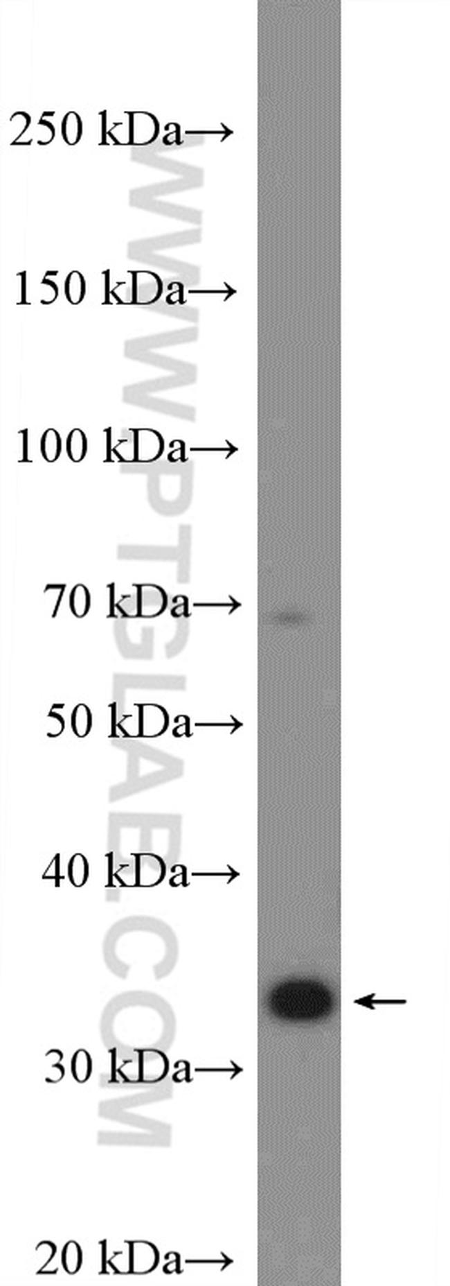 AKR1B1 Antibody in Western Blot (WB)